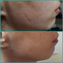 Lade das Bild in den Galerie-Viewer, Korrigierende Körperbehandlung (1 Sitzung) - BLOOMEA