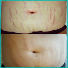 Lade das Bild in den Galerie-Viewer, Korrigierende Körperbehandlung (1 Sitzung) - BLOOMEA