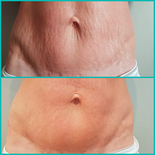 Lade das Bild in den Galerie-Viewer, Korrigierende Körperbehandlung (1 Sitzung) - BLOOMEA