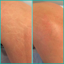 Lade das Bild in den Galerie-Viewer, Korrigierende Körperbehandlung (1 Sitzung) - BLOOMEA