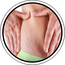 Lade das Bild in den Galerie-Viewer, Korrigierende Körperbehandlung (1 Sitzung) - BLOOMEA